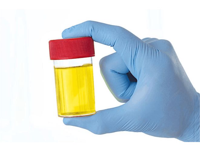 Urine tests are the most common type of drug test. These test for THC metabolites leaving the body through urine.